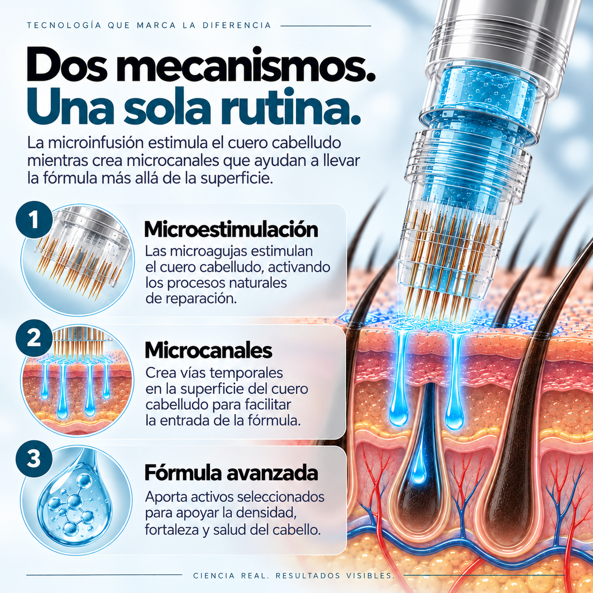 Tratamiento de microinfusión capilar